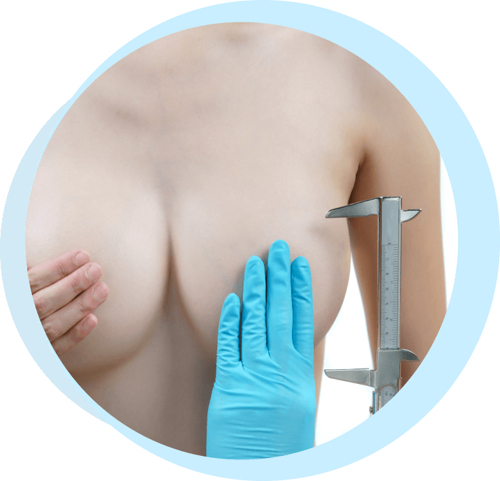 what should be done before breast reduction