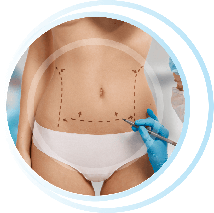 what is liposuction