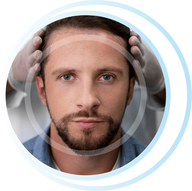 what is dhi hair transplant