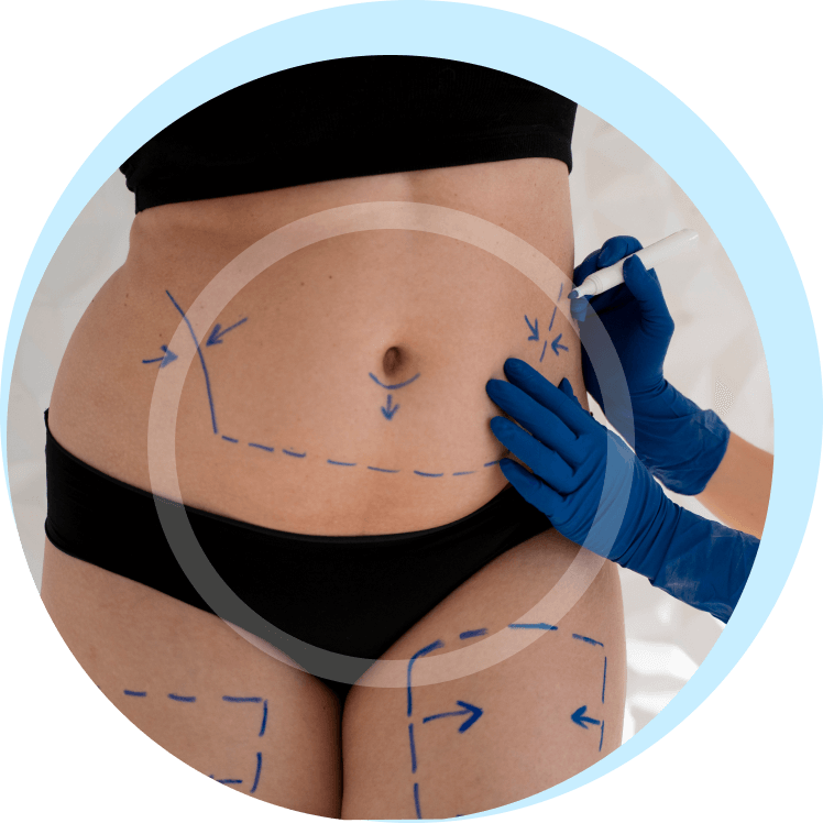 Am I a good candidate for tummy tuck turkey