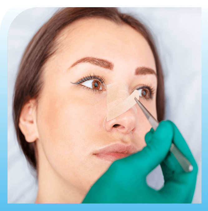 what should be expected from Rhinoplasty Turkey