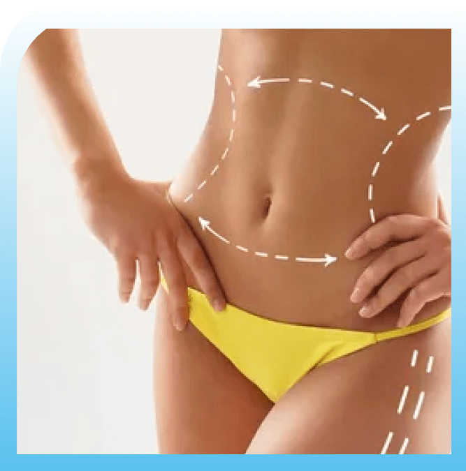 Improved body contours with vaser liposuction