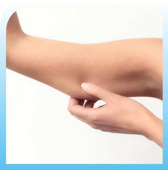 what are the results of upper arm lift