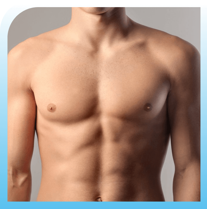 what should be done before gynecomastia surgery