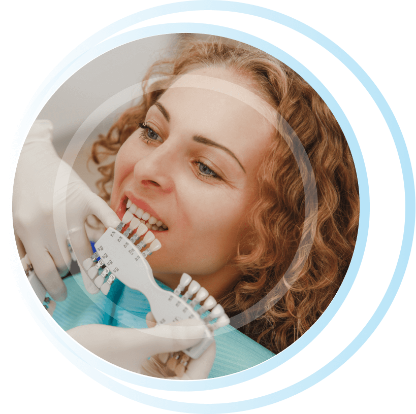 what is dental veneer