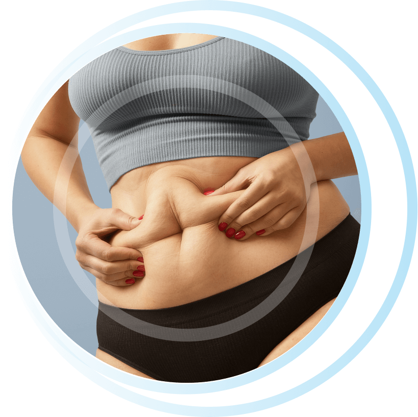 what is gastric bypass 