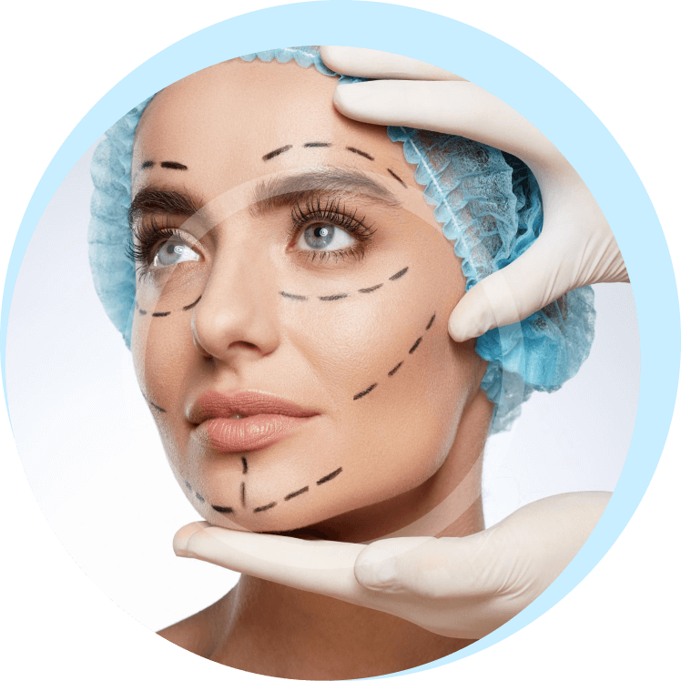 how long is the lifespan of cheek lift