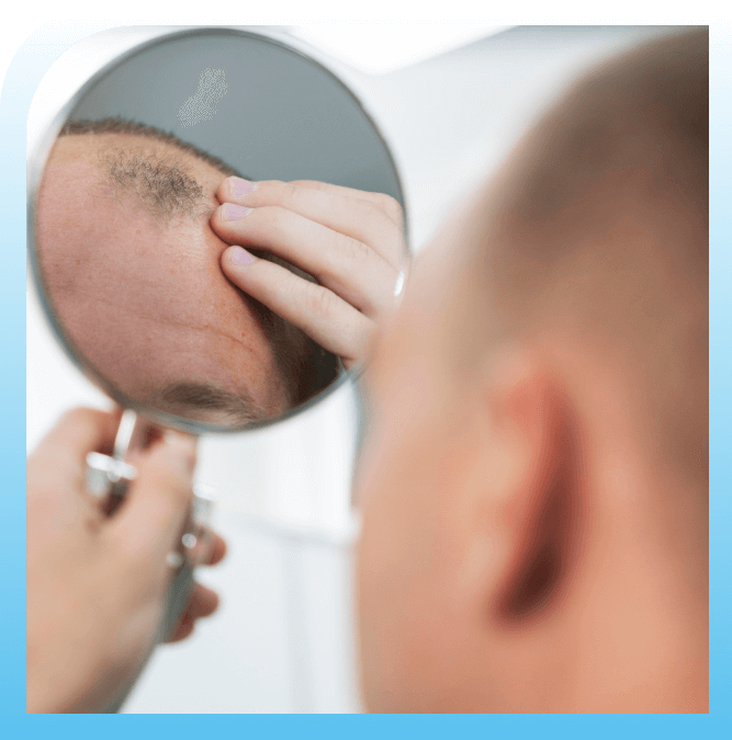 what are the benefits of dhi hair transplant