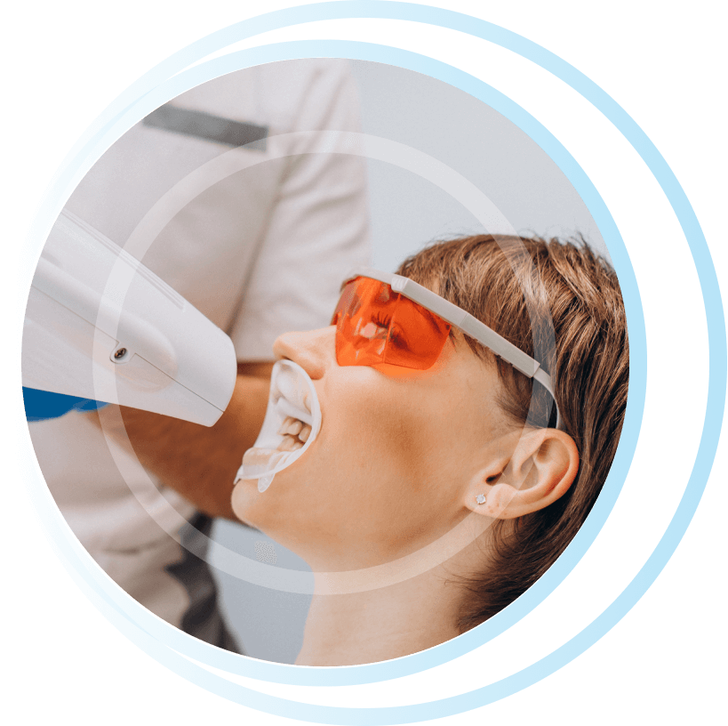 Excellent Results With Whitening Teeth Vitapera