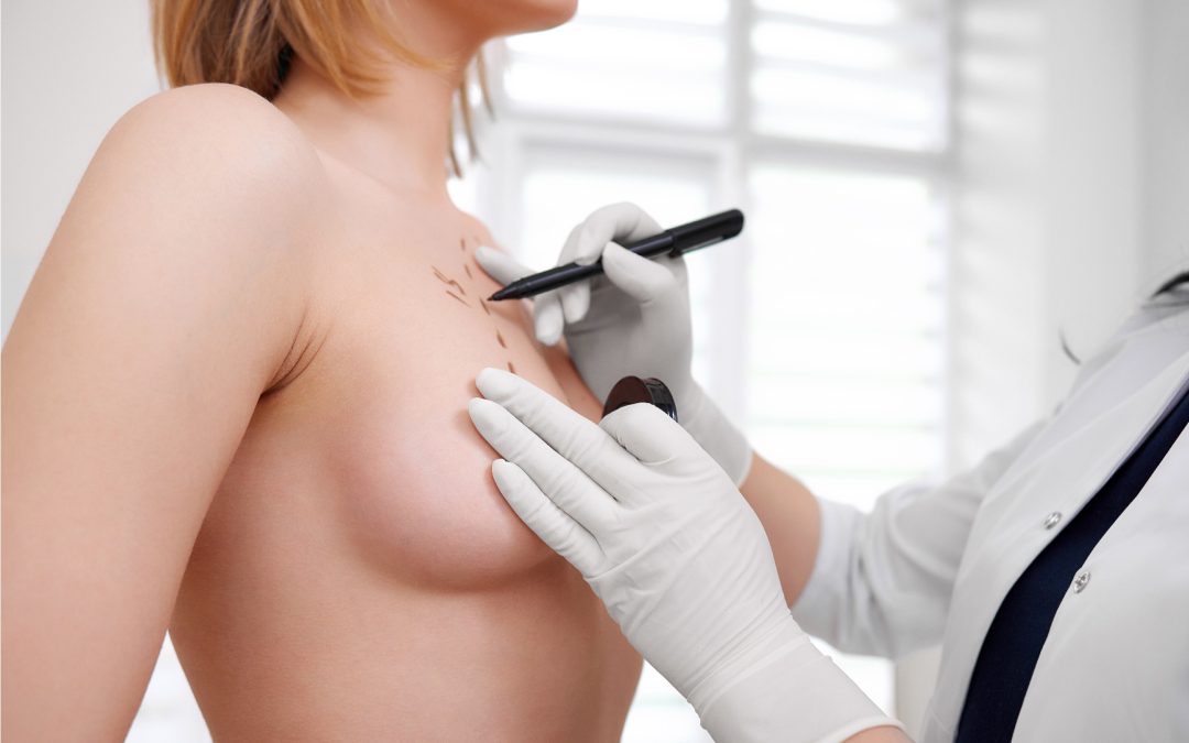 Elite Breast Aesthetics in Turkey (Breast lifts & More)
