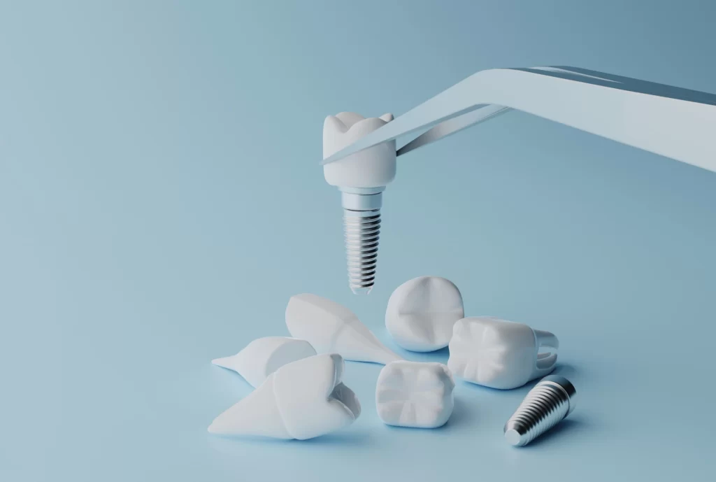 A dental implant machine