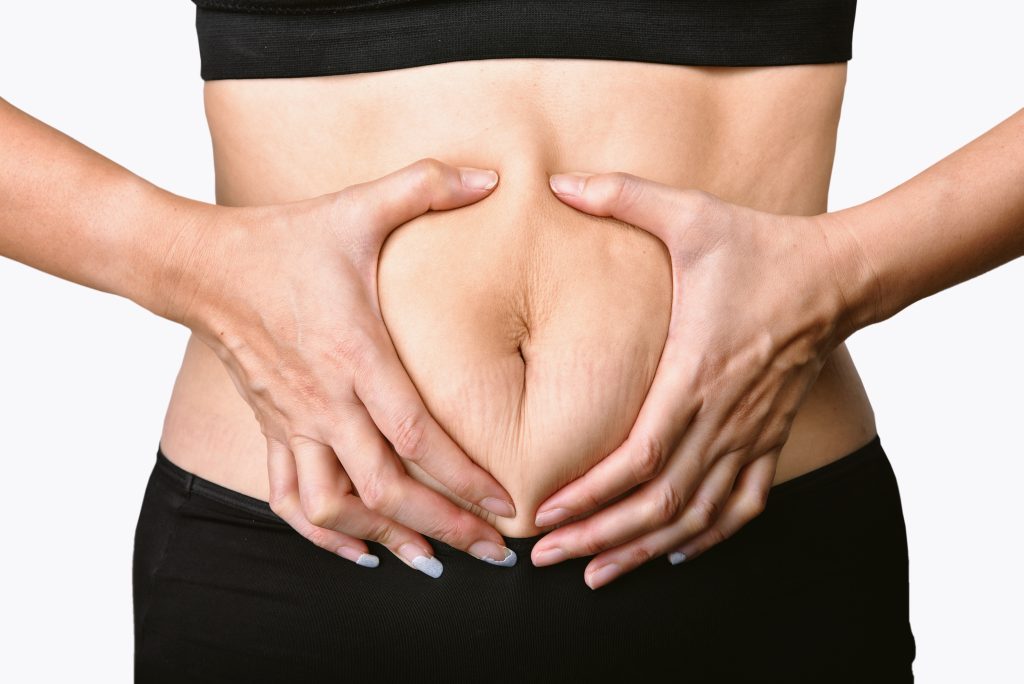 what-is-the-process-of-liposuction-in-turkey