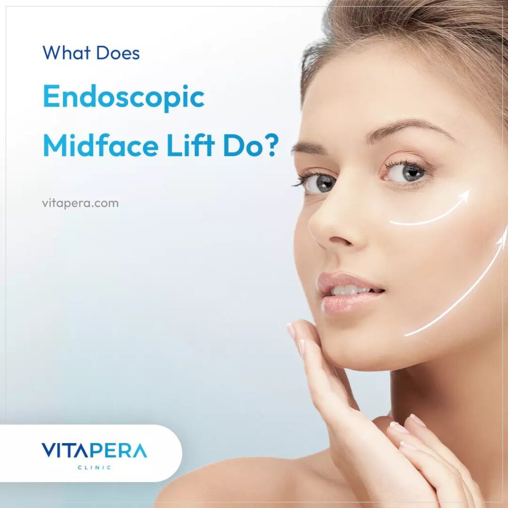 Cheek Lift in Turkey: The Ultimate Guide cheek lift