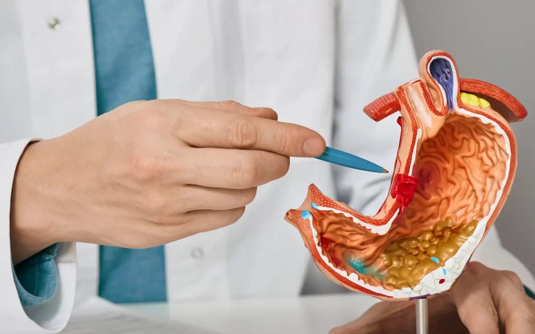 How to Stop Weight Gain After Gastric Sleeve