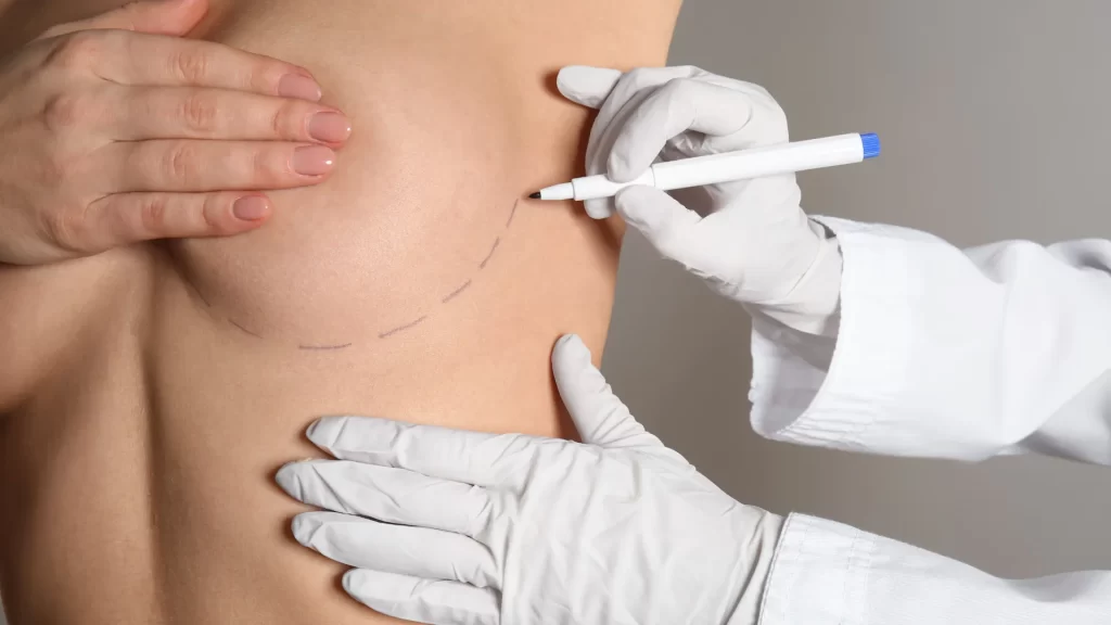 breast-lift-surgery-istanbul-turkey