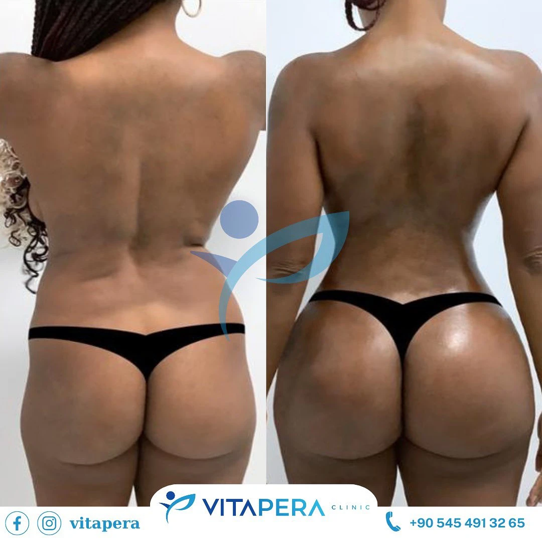 bbl ebony model Our Results