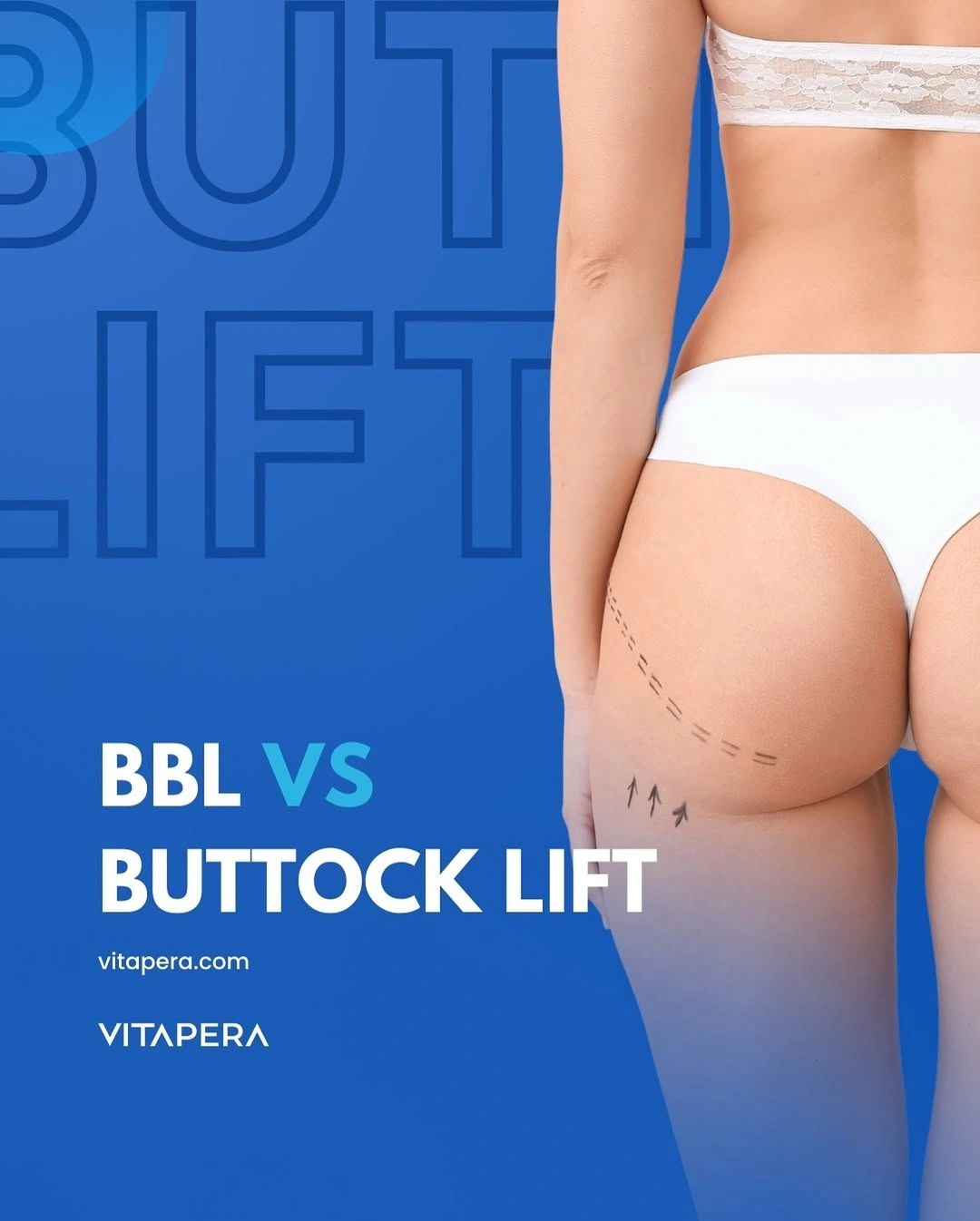 bbl vs butt lift Our Results